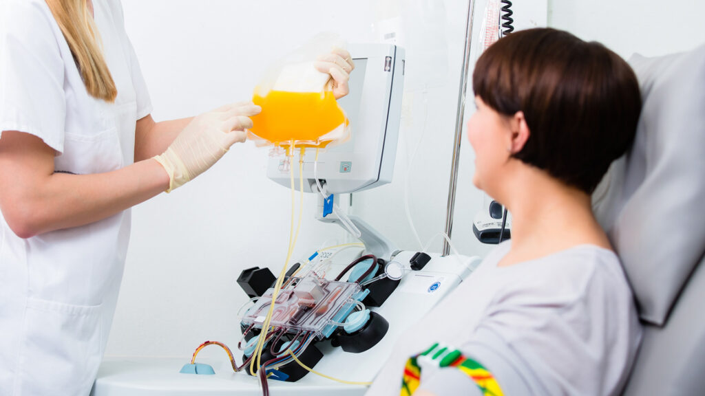 Intervencija: Terapijska izmjena plazme i primjena imunoglobulina